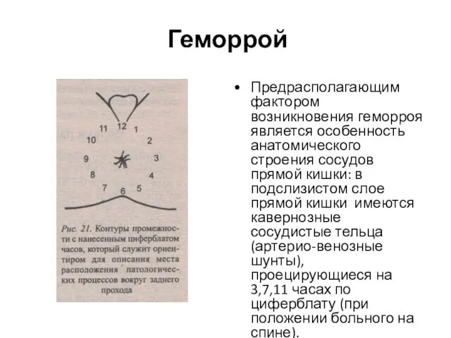 Геморрой Предрасполагающим фактором возникновения геморроя является особенность анатомического строения сосудов