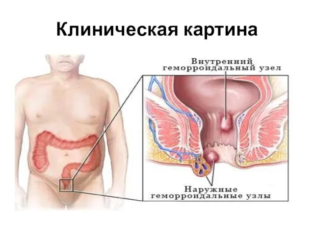 Клиническая картина