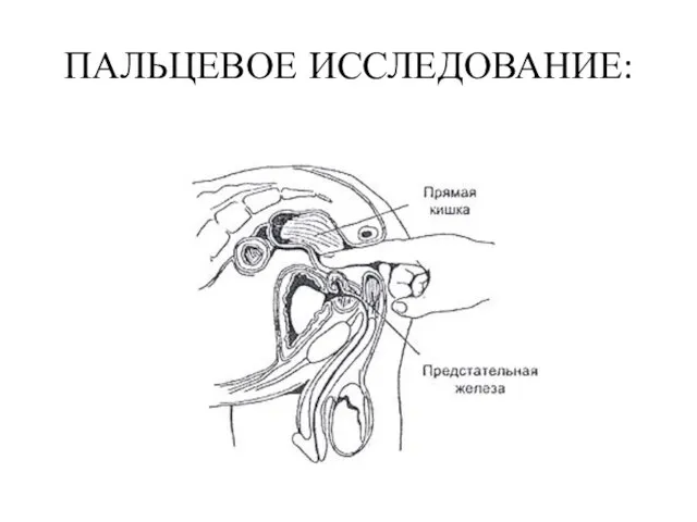 ПАЛЬЦЕВОЕ ИССЛЕДОВАНИЕ: