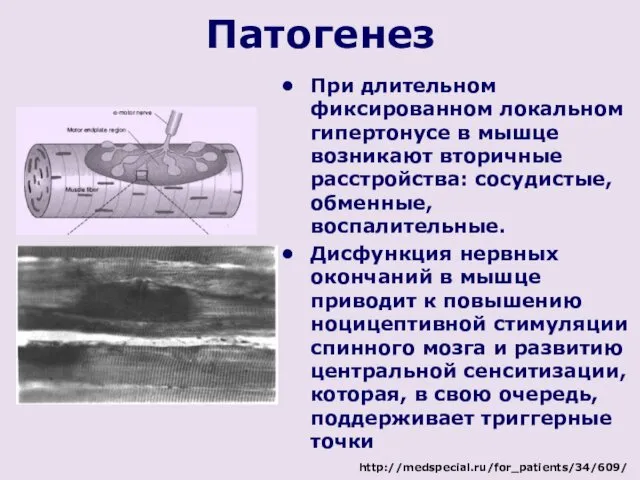 Патогенез При длительном фиксированном локальном гипертонусе в мышце возникают вторичные