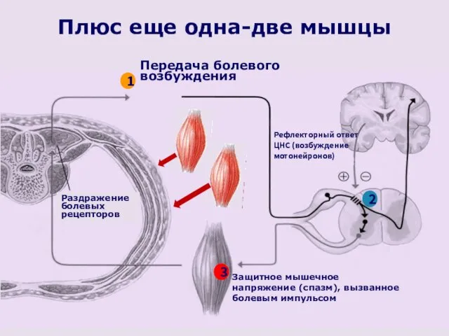 Плюс еще одна-две мышцы Раздражение болевых рецепторов Защитное мышечное напряжение