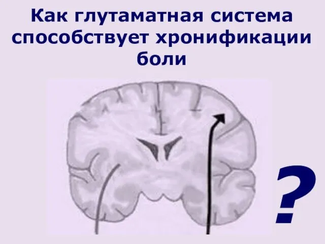 Как глутаматная система способствует хронификации боли ?