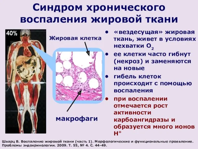 Синдром хронического воспаления жировой ткани Жировая клетка макрофаги Шварц В.