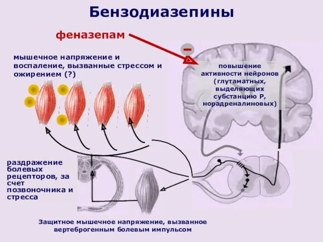 Защитное мышечное напряжение, вызванное вертеброгенным болевым импульсом повышение активности нейронов