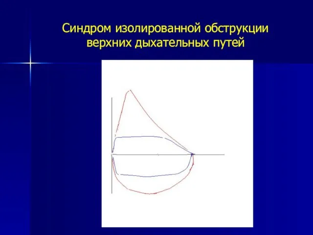 Синдром изолированной обструкции верхних дыхательных путей