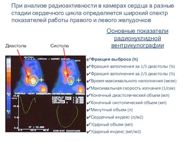 Диастола Систола При анализе радиоактивности в камерах сердца в разные