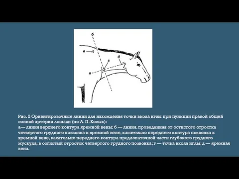 Рис. 2 Ориентировочные линии для нахождения точки вкола иглы при