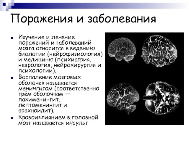 Поражения и заболевания Изучение и лечение поражений и заболеваний мозга