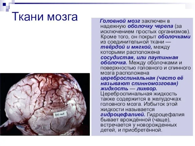 Ткани мозга Головной мозг заключен в надежную оболочку черепа (за