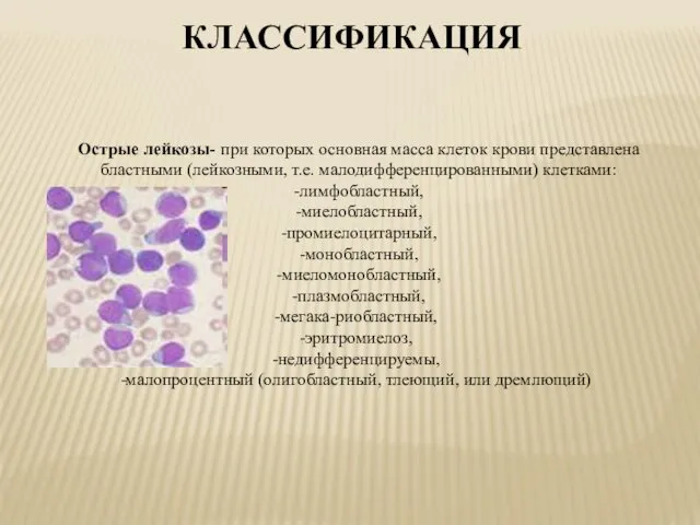 Острые лейкозы- при которых основная масса клеток крови представлена бластными