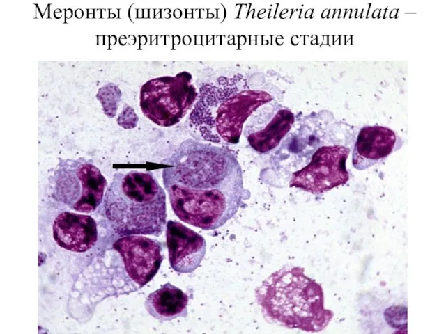 Меронты (шизонты) Theileria annulata – преэритроцитарные стадии