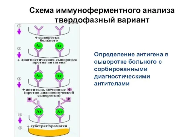 Схема иммуноферментного анализа твердофазный вариант Определение антигена в сыворотке больного с сорбированными диагностическими антителами