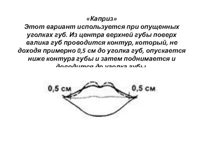 «Каприз» Этот вариант используется при опущенных уголках губ. Из центра верхней губы поверх