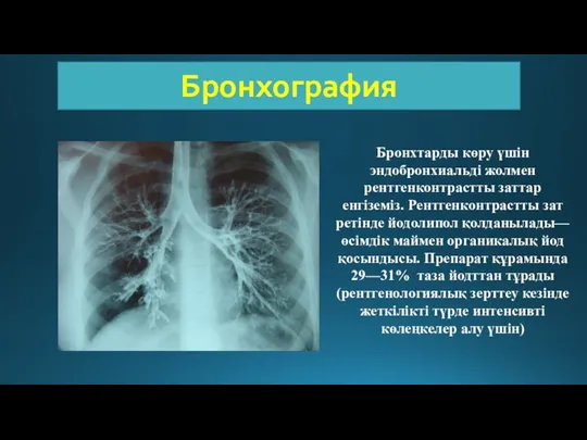 Бронхография Бронхтарды көру үшін эндобронхиальді жолмен рентгенконтрастты заттар енгіземіз. Рентгенконтрастты