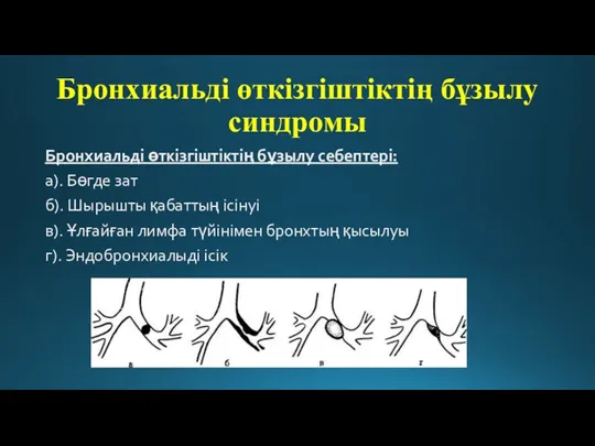 Бронхиальді өткізгіштіктің бұзылу синдромы Бронхиальді өткізгіштіктің бұзылу себептері: а). Бөгде