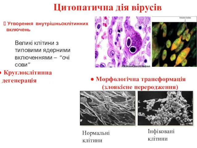 Цитопатична дія вірусів Морфологічна трансформація (злоякісне переродження) Утворення внутрішньоклітинних включень