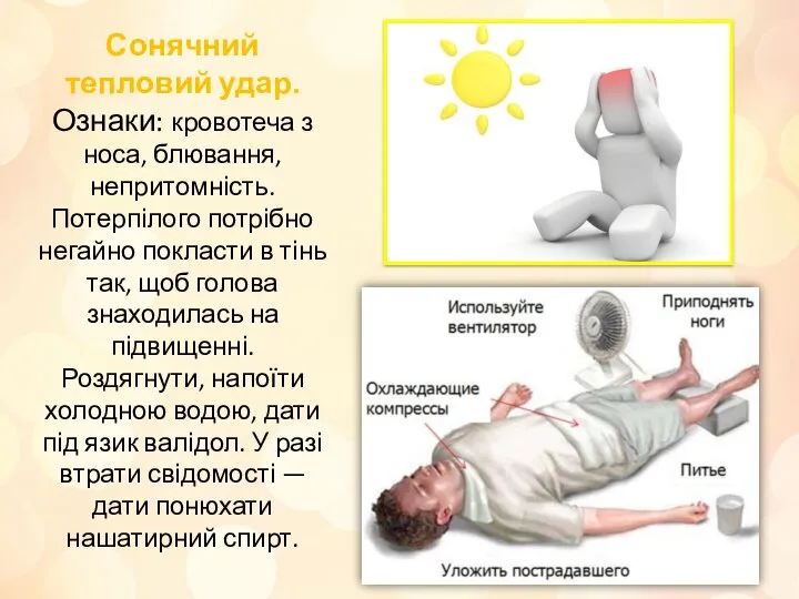 Сонячний тепловий удар. Ознаки: кровотеча з носа, блювання, непритомність. Потерпілого