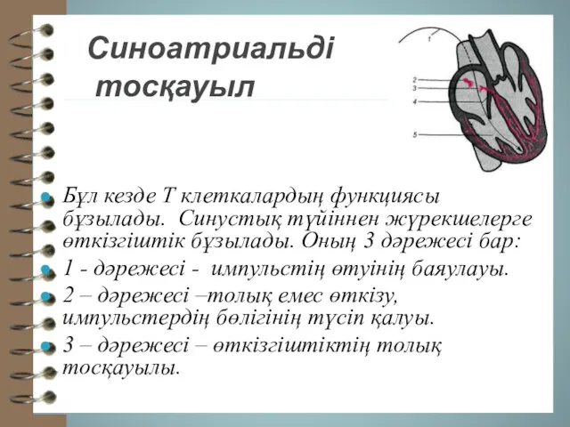 Синоатриальді тосқауыл Бұл кезде Т клеткалардың функциясы бұзылады. Синустық түйіннен