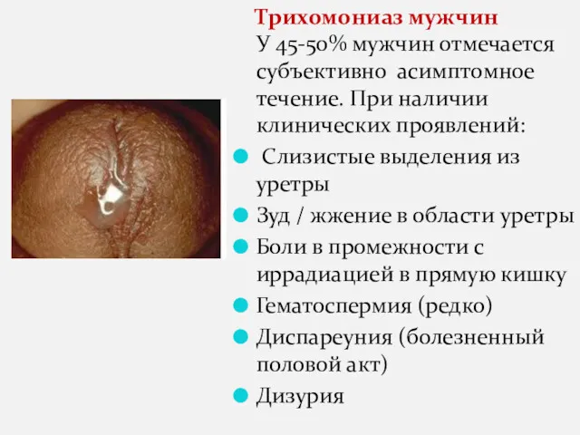 Трихомониаз мужчин У 45-50% мужчин отмечается субъективно асимптомное течение. При