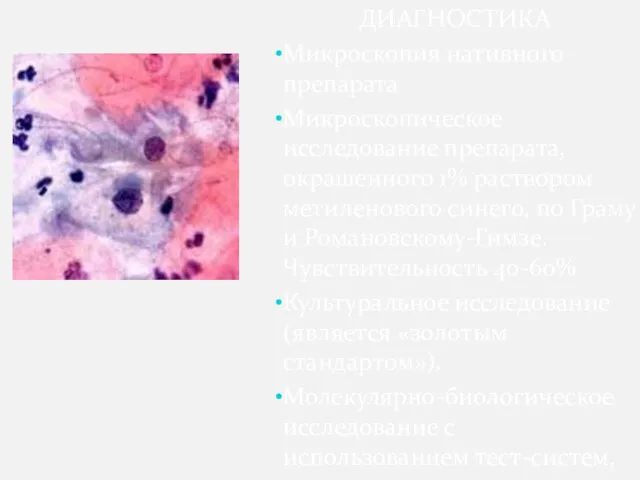 ДИАГНОСТИКА Микроскопия нативного препарата Микроскопическое исследование препарата, окрашенного 1% раствором