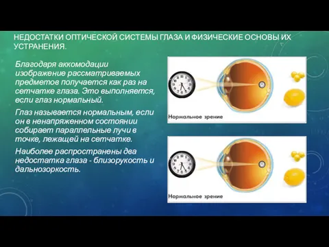 НЕДОСТАТКИ ОПТИЧЕСКОЙ СИСТЕМЫ ГЛАЗА И ФИЗИЧЕСКИЕ ОСНОВЫ ИХ УСТРАНЕНИЯ. Благодаря