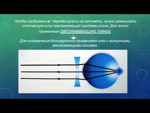 Чтобы изображение передвинулось на сетчатку, нужно уменьшить оптическую силу преломляющей