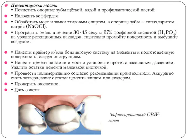 Цементировка моста • Почистить опорные зубы щёткой, водой и профилактической