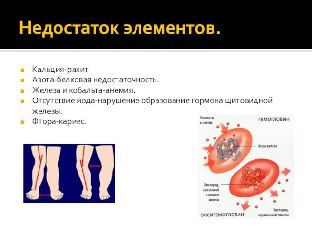 Недостаток элементов. Кальция-рахит Азота-белковая недостаточность. Железа и кобальта-анемия. Отсутствие йода-нарушение образование гормона щитовидной железы. Фтора-кариес.