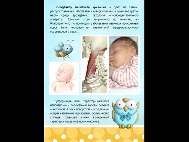 Врождённая мышечная кривошея – одно из самых распространённых заболеваний новорождённых и занимает третье