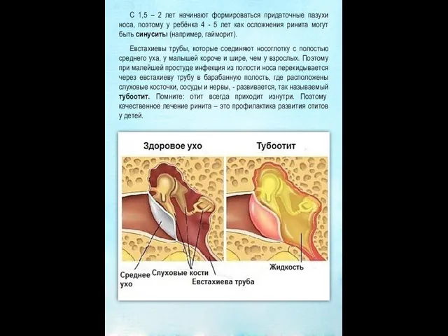 С 1,5 – 2 лет начинают формироваться придаточные пазухи носа, поэтому у ребёнка