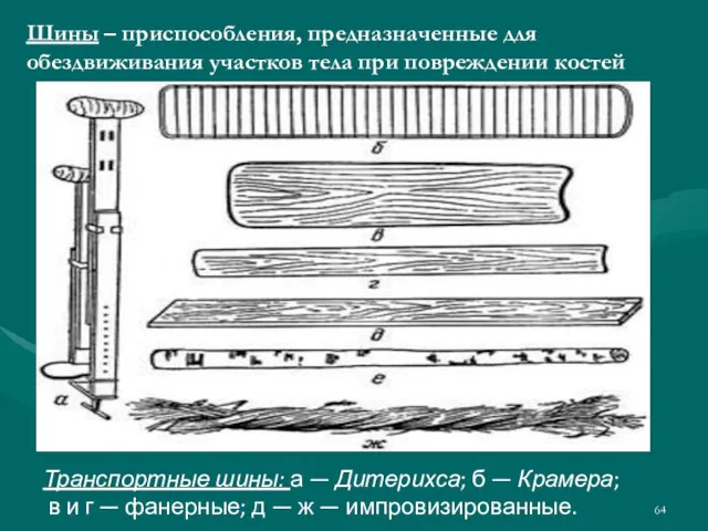 Шины – приспособления, предназначенные для обездвиживания участков тела при повреждении