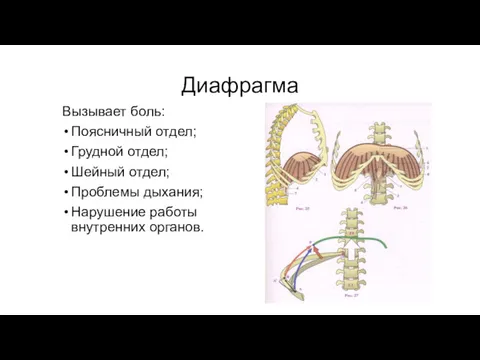 Диафрагма Вызывает боль: Поясничный отдел; Грудной отдел; Шейный отдел; Проблемы дыхания; Нарушение работы внутренних органов.