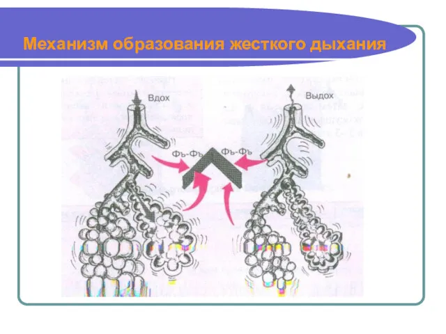 Механизм образования жесткого дыхания