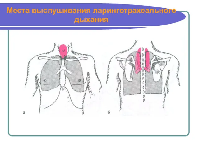 Места выслушивания ларинготрахеального дыхания