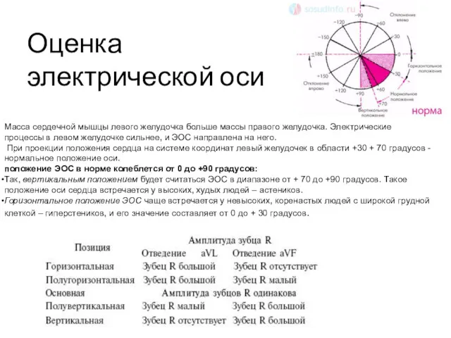 Оценка электрической оси Масса сердечной мышцы левого желудочка больше массы