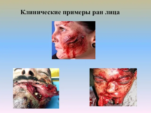 Клинические примеры ран лица