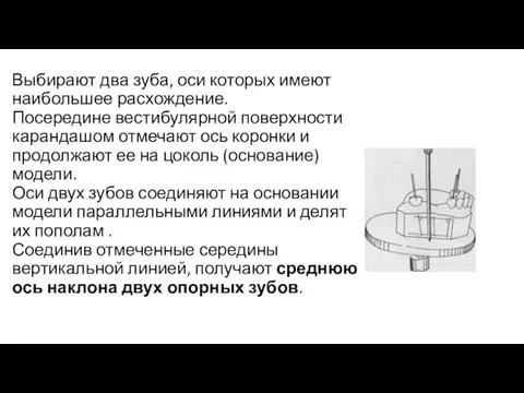 Выбирают два зуба, оси которых имеют наибольшее расхождение. Посередине вестибулярной