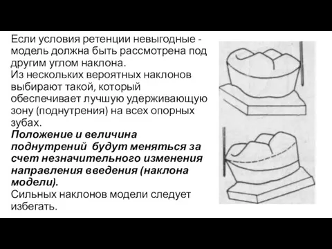 Если условия ретенции невыгодные - модель должна быть рассмотрена под