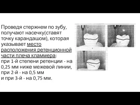 Проведя стержнем по зубу, получают насечку(ставят точку карандашом), которая указывает