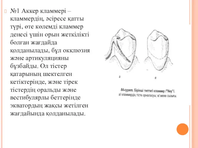 №1 Аккер кламмері – кламмердің, әсіресе қатты түрі, өте көлемді