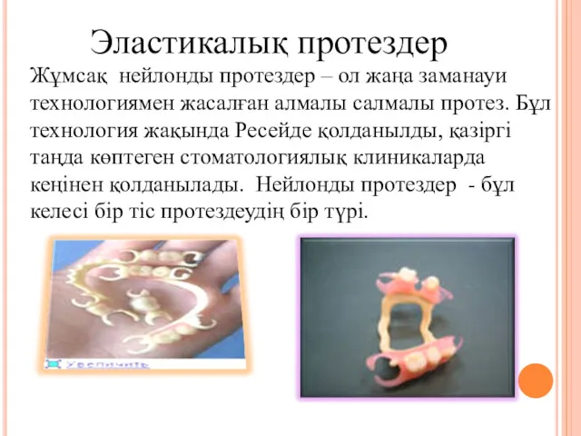 Эластикалық протездер Жұмсақ нейлонды протездер – ол жаңа заманауи технологиямен