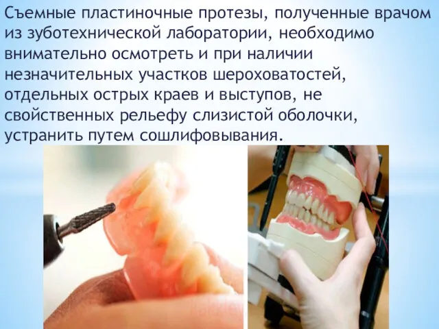 Съемные пластиночные протезы, полученные врачом из зуботехнической лаборатории, необходимо внимательно