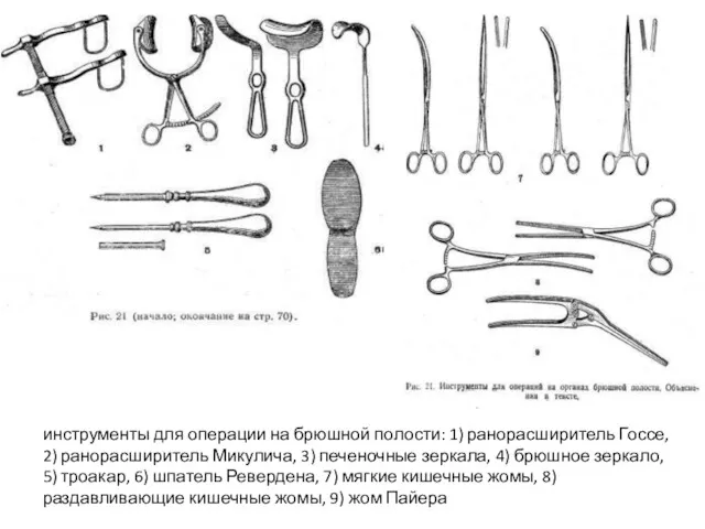 инструменты для операции на брюшной полости: 1) ранорасширитель Госсе, 2)