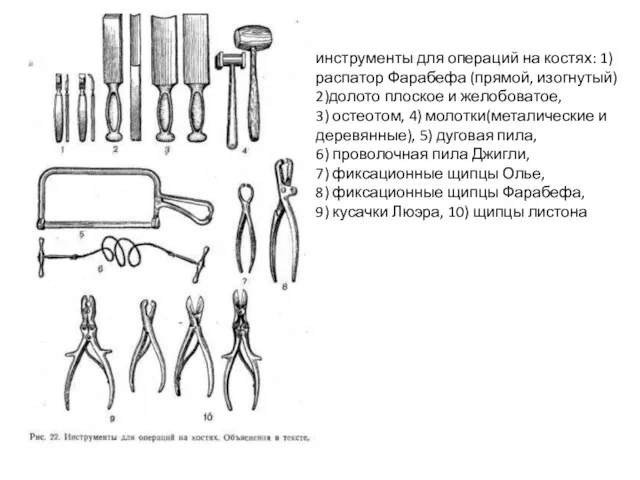 инструменты для операций на костях: 1) распатор Фарабефа (прямой, изогнутый)