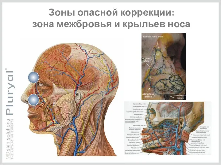 Зоны опасной коррекции: зона межбровья и крыльев носа