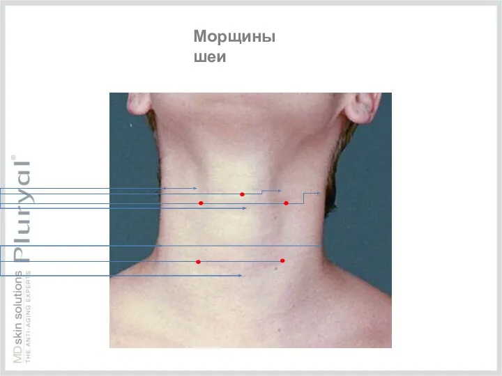 Морщины шеи