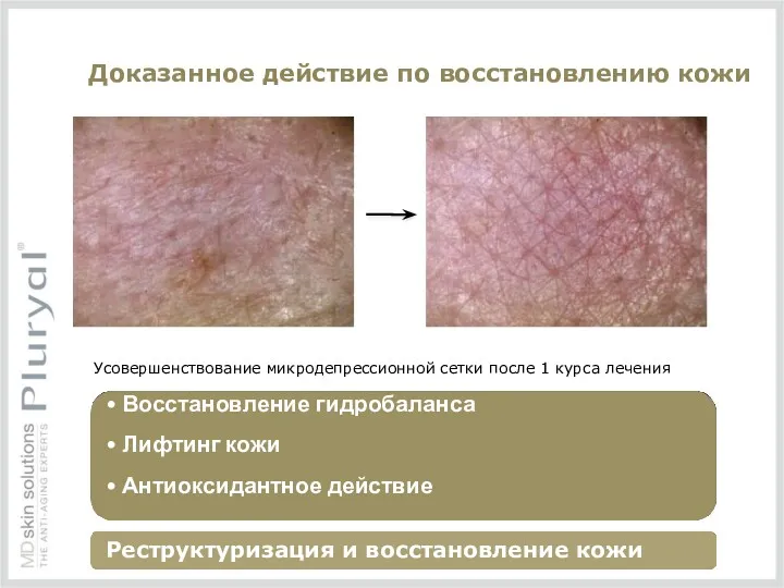 Доказанное действие по восстановлению кожи Усовершенствование микродепрессионной сетки после 1 курса лечения •