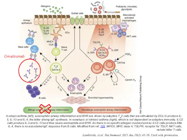 In atopic asthma (left), eosinophilic airway inflammation and BHR are