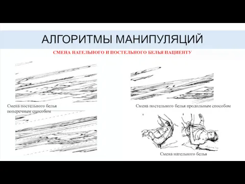 АЛГОРИТМЫ МАНИПУЛЯЦИЙ СМЕНА НАТЕЛЬНОГО И ПОСТЕЛЬНОГО БЕЛЬЯ ПАЦИЕНТУ Смена постельного