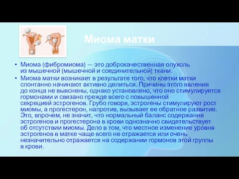 Миома матки Миома (фибромиома) — это доброкачественная опухоль из мышечной